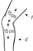 Kniebandage StabiloGen® Eco, jeans und schwarz - Farbe jeans, Größe 4+